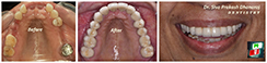 Smile Gallery
