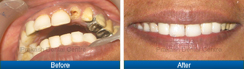 Smile Gallery